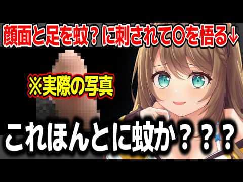 閲覧注意?顔面と足が腫れすぎて化け物に刺されたと語る栗駒こまるw【あおぎり高校/切り抜き】